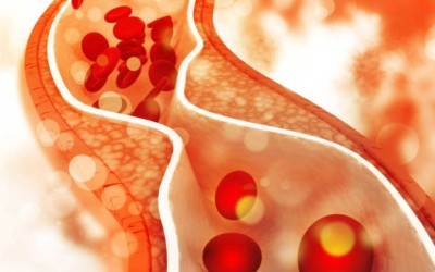 Everything You Need To Know About Cholesterol