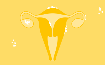 Endometriosis - Everything you need to know about it.