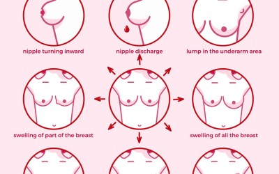 What Is Breast Cancer?